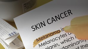 Melanoma Prevention Recommendations