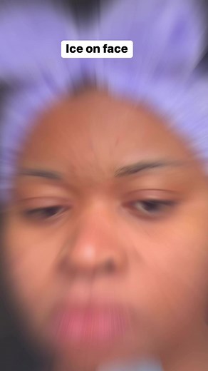 One of my go-to for acne breakouts.. #iceblock #iceblockonface #acne #acne breakout | Edeze Ruth | Facebook