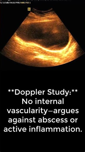 “Hard Lump After C-Section | Post-Surgical Fat Necrosis on Ultrasound Explained”**