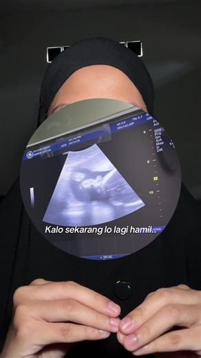 Perawatan Bayi Baru Lahir yang Tepat di Rumah