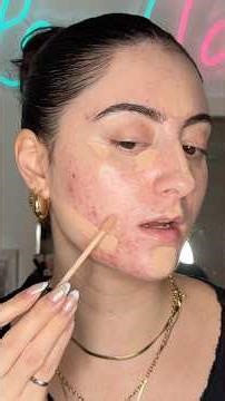 Neutrogena radiant concealer review 🫢😍✨ #realskintexture #makeuptutorial #acnecoverage