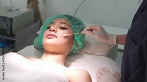 Botox,Collagen injections prepare. B Roll of Beauty clinic business concept. Beautician hands in gloves preparing botox injection in a face skin. Asian woman gets beauty facial cosmetology procedure.