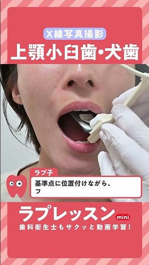 【ラプレッスンmini】X線写真撮影 04.上顎小臼歯・犬歯の撮影手順