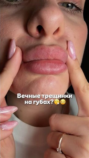 #WW194035 lip kit (enter the article number with two WW) RP