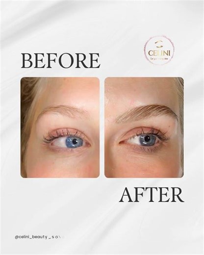 ✨ Eyebrow Lamination — Before & After ✨