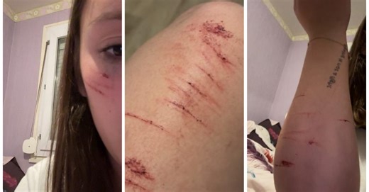Louanne, 18 ans, promenait son chien dans son quartier quand elle a fait une terrible rencontre : « Il a attrapé la laisse et m’a tabassée… il n’arrêtait pas »