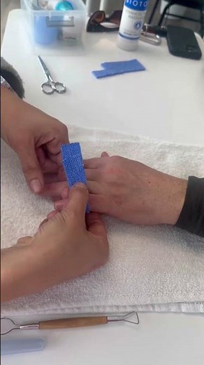 Small Finger DIP Flexion Assist Buddy Strap Orthosis #handtherapy #jointpainrelief #jointstiffness