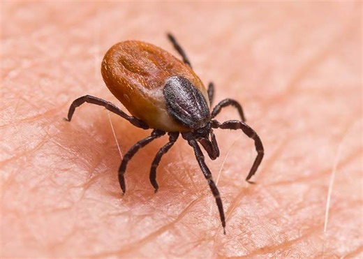The Best and Worst Way to Remove a Tick