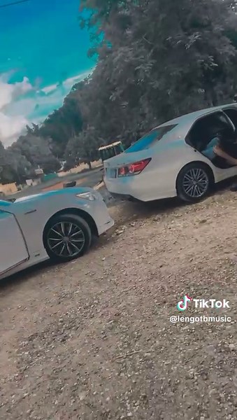 Getting Crowns On My Teeth: A Personal Journey