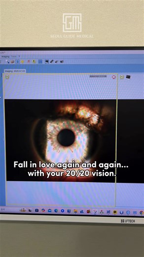 Fall in love again and again… with your 20/20 vision. 👁️💎✨ Experience the precision and technology that makes Korea one of the world’s leaders in vision correction. Whether it’s LASIK, LASEK, or SMILE Eye Surgery, Korean ophthalmologists use advanced diagnostic systems to design results that are: ✔️ Precise ✔️ Painless ✔️ Tailored just for your eyes 📍 Performed in Seoul with SGM, connecting patients worldwide with Korea’s top-certified eye surgeons, full English support, and VIP aftercare. 🇰