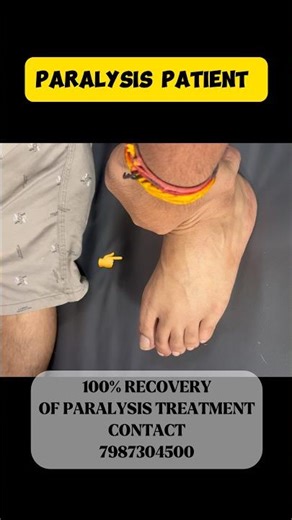 Recovery Of Paralysis Patient 💪