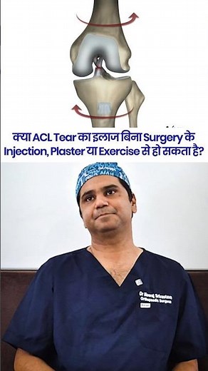 क्या ACL Tear का इलाज बिना Surgery के Injection, Plaster या Excercise से हो सकता है ? | Dr Neeraj