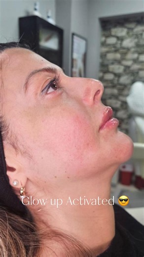 No olviden que cuidar de su piel no es un gasto, ¡es inversión! 🤩 💌 ¡Agenda tu cita ahora! Link en nuestro perfil Tender Touch Esthetic 📲 1 754 214 0362 📍 851 W. State Rd. 436, Ste. 1033, Altamonte Springs, FL, United States #orlando #tendertouch #orlandofl #esthetician #treatment meme fun funny