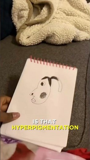 Skin Lesson From The Hyperpigmentation Meme