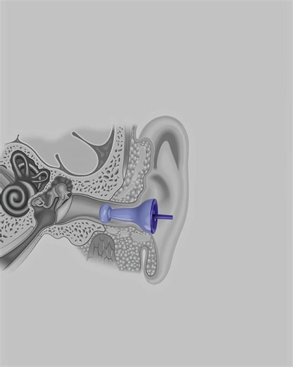 This Tiny Plug Silences Everything! 😳 . . . #inflatableearplugs​ #facts​ #trending​ #viral​ #new​ #latest | Creative Hub.