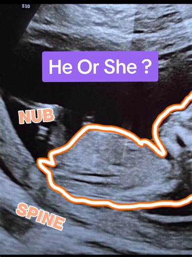 Guess the Baby's Gender: Boy or Girl?