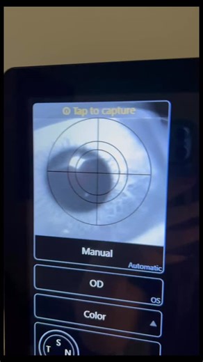Dr.s Kopolow & Girisgen on Instagram: "Up close look at our Optomap in action 👁️ The Optomap takes a picture of your retina and is a great way for your optometrist to evaluate the health of your eyes Have you ever used the Optomap at your eye exam?? #optometry #eyeexam #optomap #reels #lasvegaseyedocs"