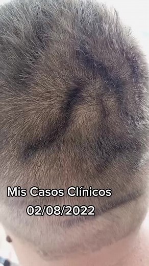 Clinical Dermatology Cases: Skin Condition Insights