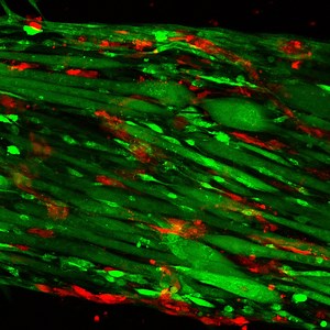 Following injury, a new approach could help rebuild muscle