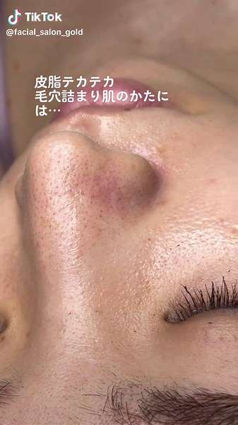 【スキンケア編】皮脂分泌が過剰な方は、基本のスキンケアにビタミンC誘導体の美容液をプラスして、お手入れをしてみてください😊ビタミンC誘導体→皮脂抑制作用、抗酸化作用、ターンオーバー促進、毛穴の引き締め効果など✨(お肌の乾燥からくる、ニキビや肌荒れがある方はオススメしません🥲)