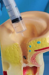 41K views · 118 reactions | Inside the Clinic: Real Medical Procedures Explained | Health is Wealth | Facebook