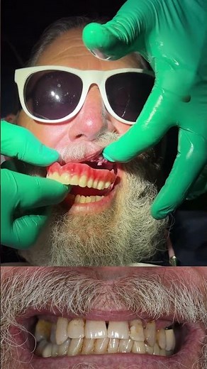 How to replace bad teeth with new ones