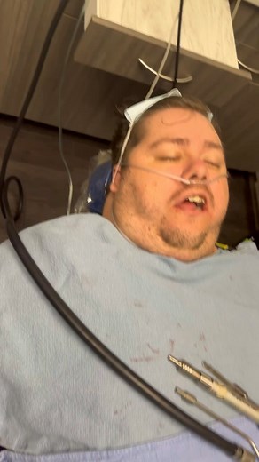 Shaun Young on Instagram: "Posted for educational purposes and with the patient’s permission! Precedex is a game changer! In my mind, it has and will change the way Oral and Maxillofacial Surgeons perform office based anesthesia. Patient expectations need to be addressed! Patients do not get upset when outcomes are not a surprise. This 39 yo gentleman presented to our office for extraction of all four wisdom teeth. His medical history included mild intermittent asthma and morbid obesity, current