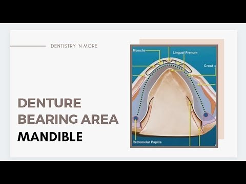 DENTURE BEARING AREA -MANDIBLE