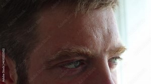 Perspiring guy. This close up macro video shows a nervous man's sweating skin of forehead.