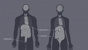 Centers for Disease Control and Prevention (CDC) - Cancer - What is cancer? (YouTube)