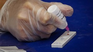 Test rápido de VIH: En qué consiste y dónde te lo puedes realizar