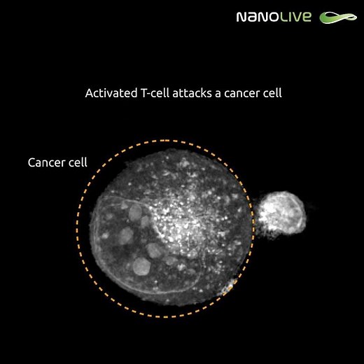 Activated T cell attacks a cancer cell