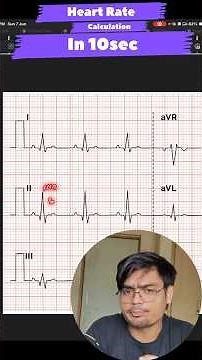 Easiest way to calculate Heart Rate #ecg #mbbslife #ask_a_medico #fmmch