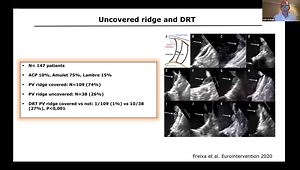 Follow-up Management: Medication, TEE, CT. What Is Important to Look at Post Amulet Implantation?