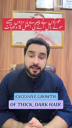 5 Reasons Women Develop Thick Facial Hair Like Men