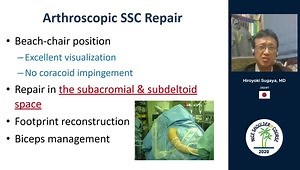 Arthroscopic Repair of Isolated Subscapularis Tears: Long-Term Outcome & Structural Integrity