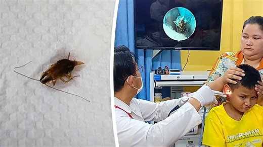 Doctor pulls live cockroach out of young boy's ear in Cambodia