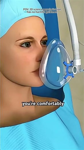 Incisionless Gastric Reflux Surgery #animation