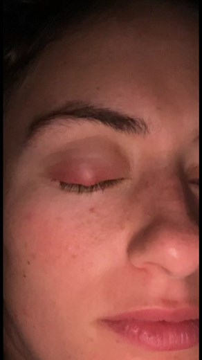 My patience, self restraint and vision all being tested at once 👁 whenever I press it, it retracts back and nothing comes out 🫠 #sty #eye #mum