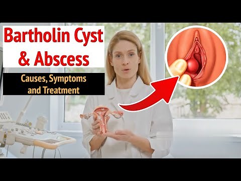 Understand Bartholin Cysts and Abscesses