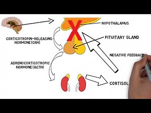 Corticotropin Releasing Hormone CRH ; how it works, key player in your body’s stress response system