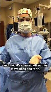 How Does Liposuction Work? | Greer Plastic Surgery