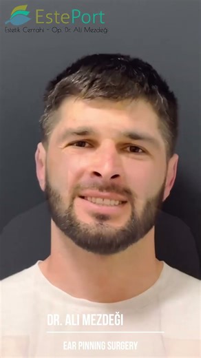 Watch This Before You Get Ear Pinning Surgery!