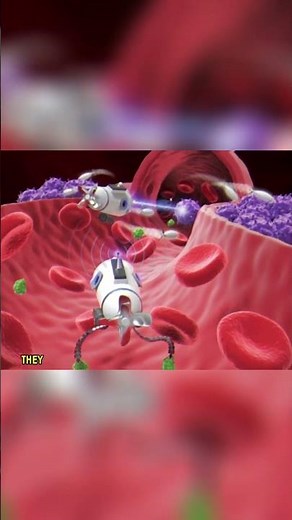 Medical Nanobots: Revolutionizing the Human Body - The Future?