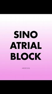 Sinus block is an abnormal cardiac rhythm that results from the failure of the sinoatrial node to conduct or produce action potentials. This leads to the intermediate pause of a cardiac cycle followed by an escape beat or the continuation of normal sinus rhythm. . . Repost from @medzcool . . #cardiology #heart #FOAMed #MedEd #healthscience #healthcare #medicalstudent #medstudent #medschool #medicalschool #medzcool #PAstudent #physician #doctor #medicine #medico #medicalassistant #NPstudent #nurs