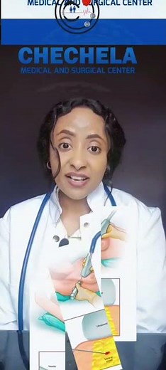 FNAC and Biopsy test for Cancer.