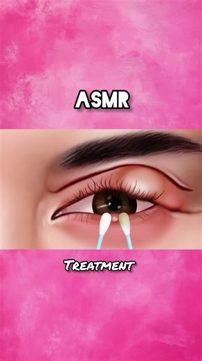 Relaxing ASMR Treatment for Stress Relief
