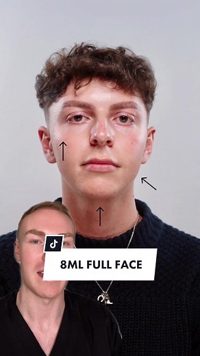 Achieve Masculine Features with Dermal Fillers