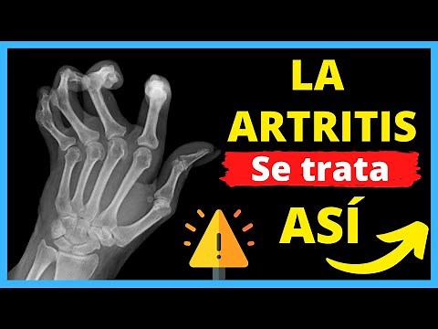💊 Los 7 Medicamentos para CURAR la ARTRITIS REUMATOIDE 💊