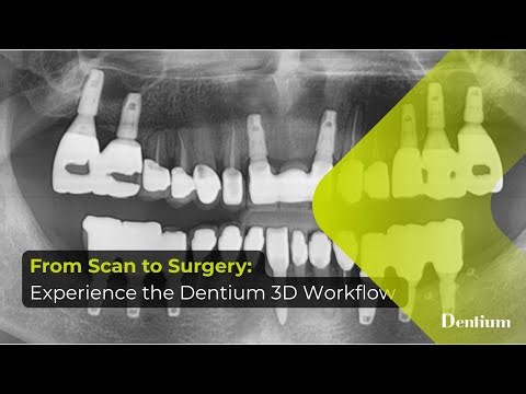 From Scan to Surgery: Experience the Dentium 3D Workflow - 02
